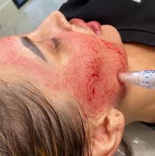 Why Peptide Serums Are a Core Ingredient in Modern Skincare